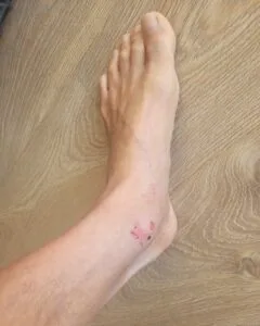 Quando ti allontani da ciò che vuoi davvero, inizi a zoppicare